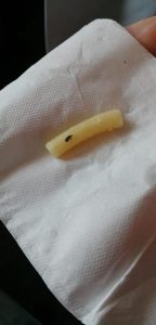 Fethiye Devlet Hastanesi’nde Yemek Skandalı