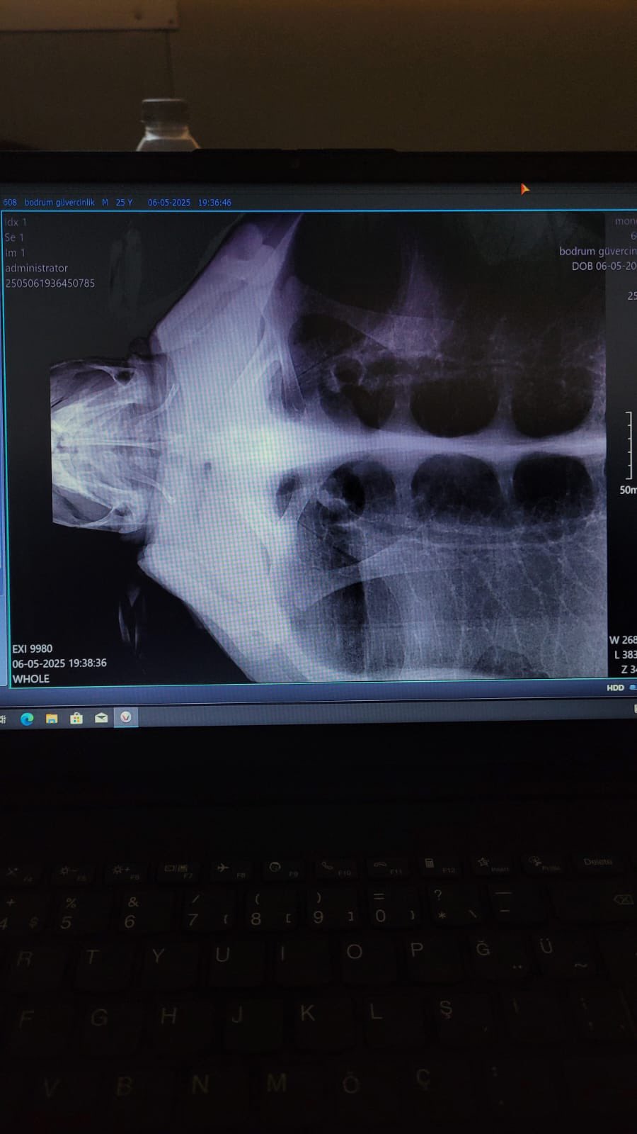 G0A Y8J T Xo A Aqtog